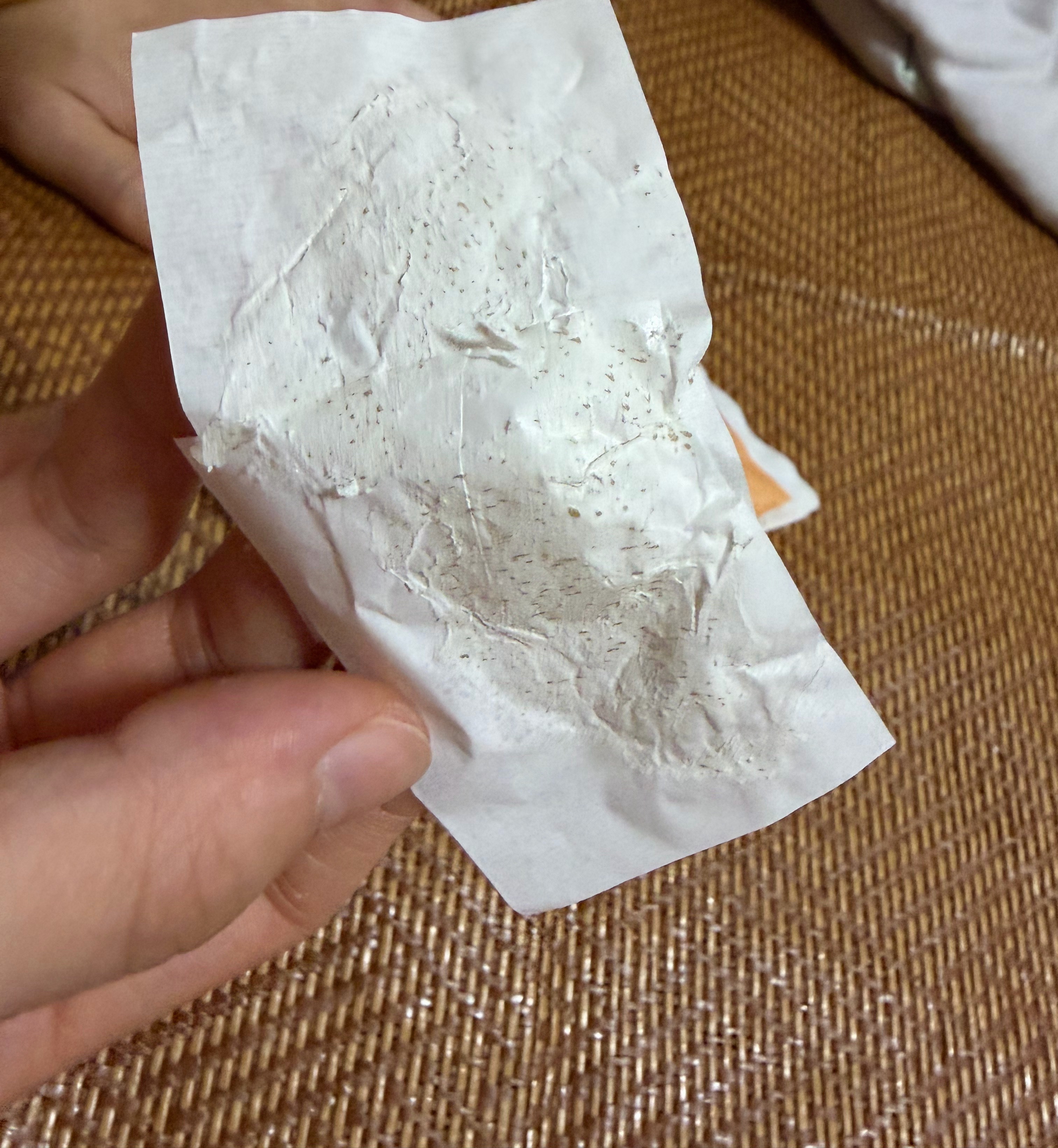 我老婆非要给我去黑头结果一弄这么多
