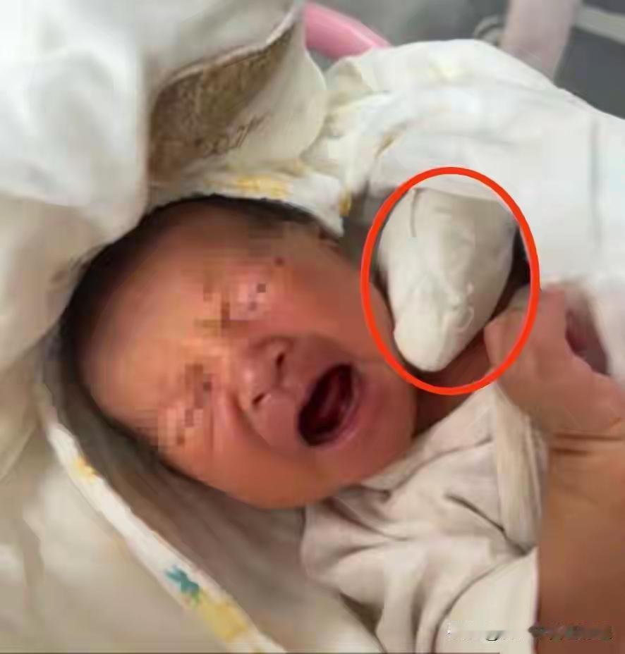 初为人父的盛先生怎么也没想到，妻子剖腹产刚生下的儿子，就因为一个“低级错误”，又