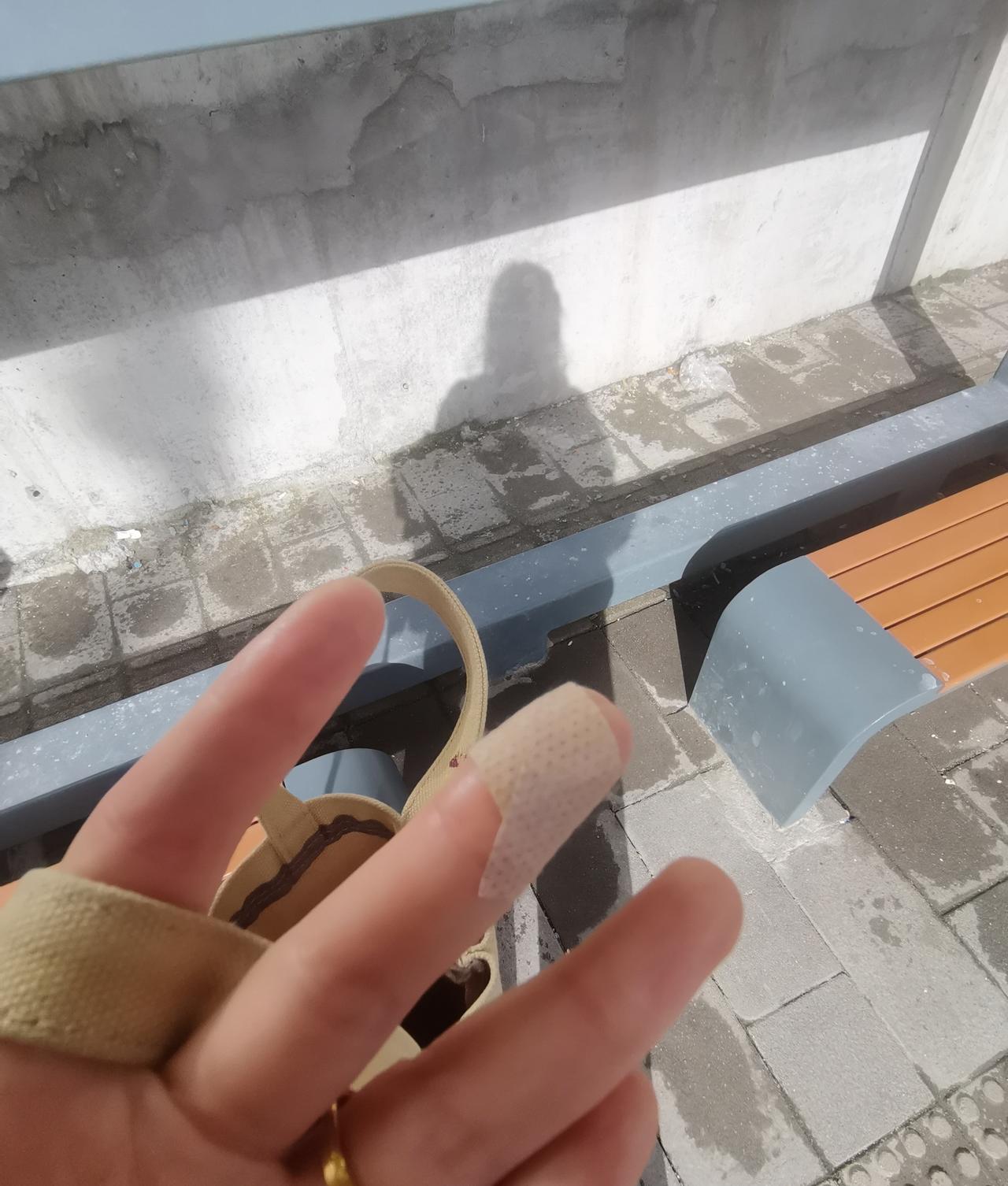 一声大喊，左手中指就这样了！突然想到一句话，人为财亡鸟为食亡，此时此刻我属于为食