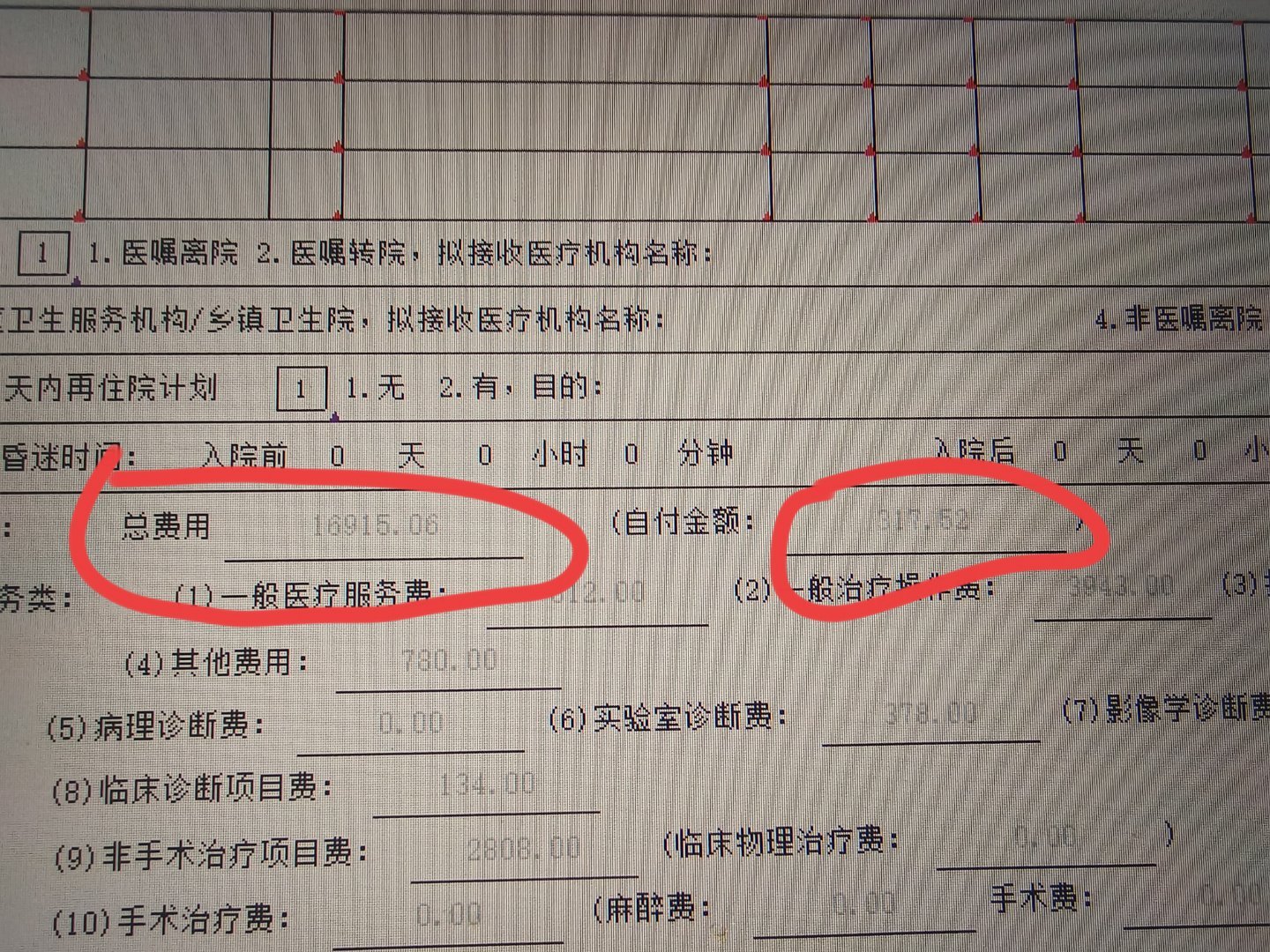 不得不说现在国家医保政策对于一些病人而言已经挺好了，这个患者住了一个月花了将近1