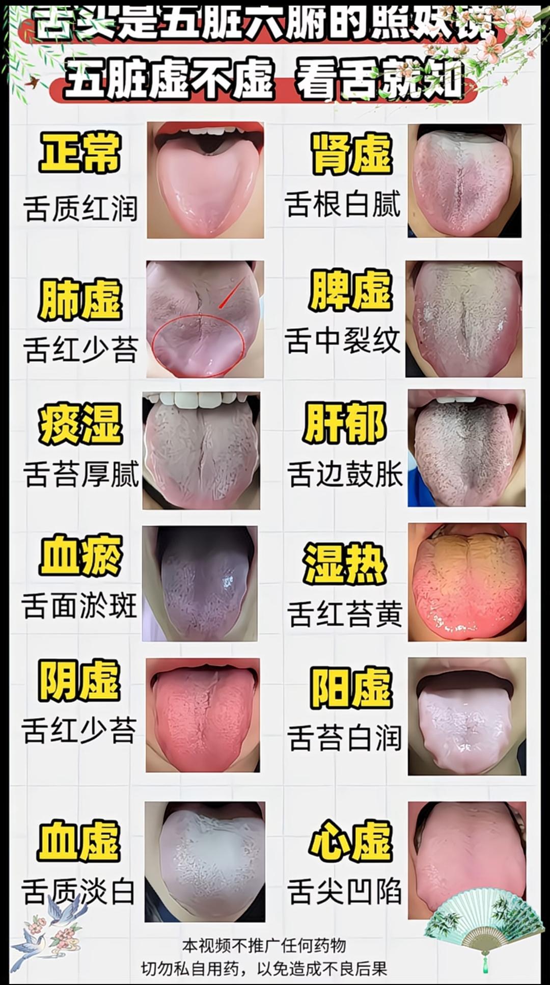 养生知识科普 舌苔白厚怎么办 舌头不同部位对应脏腑图 养生知识分享