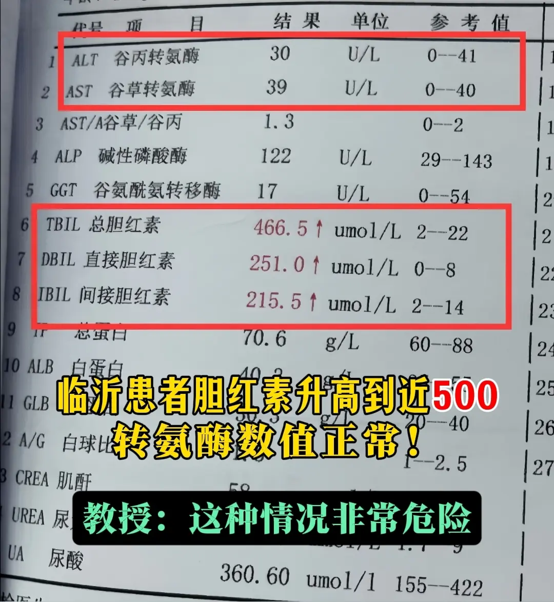 临沂这位患者，胆红素飙到近500（正常＜22μmol/L），转氨酶却正...