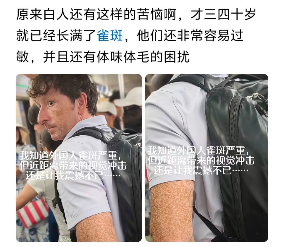 茂盛体毛➕重体体味儿➕雀斑中国人要是占一个，我都不敢想公知会怎么贬低我们 