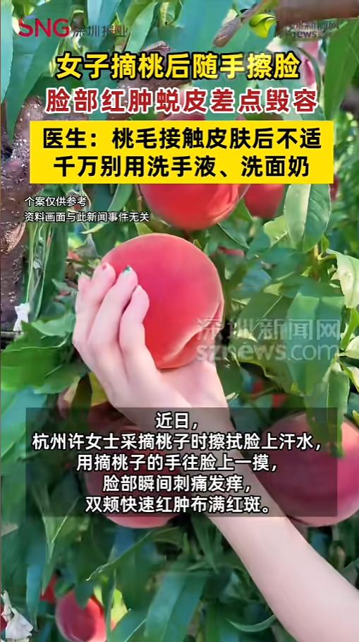 “过敏人的噩梦！”浙江杭州一名女子采摘桃子后出汗，下意识用沾有桃毛的手擦拭脸部，