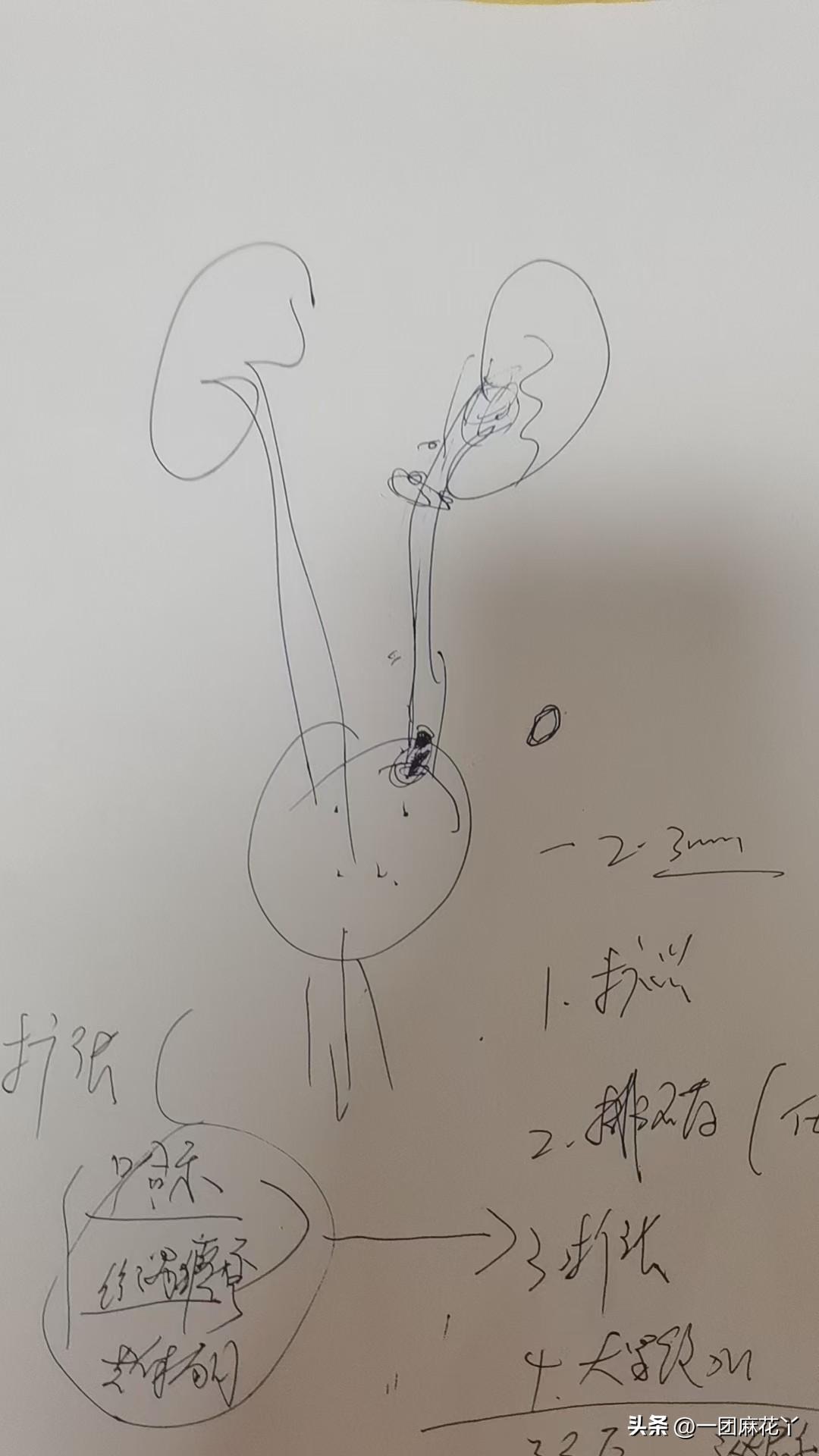 我娘说左边肋叉子疼。
肋叉子就是肋骨下缘那里。
疼的不行了，姐要带我娘去医院，打