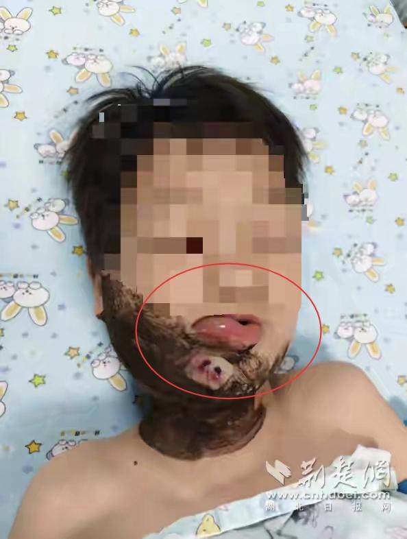 “惊魂一幕！”湖北一名8岁男孩傍晚在江边浅滩玩水，不料一条躲在暗处的黑蛇突然偷袭