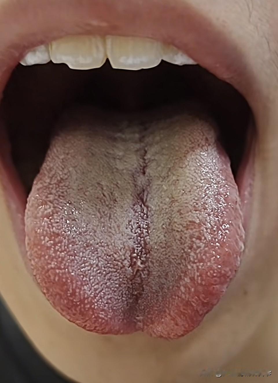 这种舌头，还想“夜夜笙歌”，简直就是“天方夜谭”

前天遇到的一位小兄弟，是真的