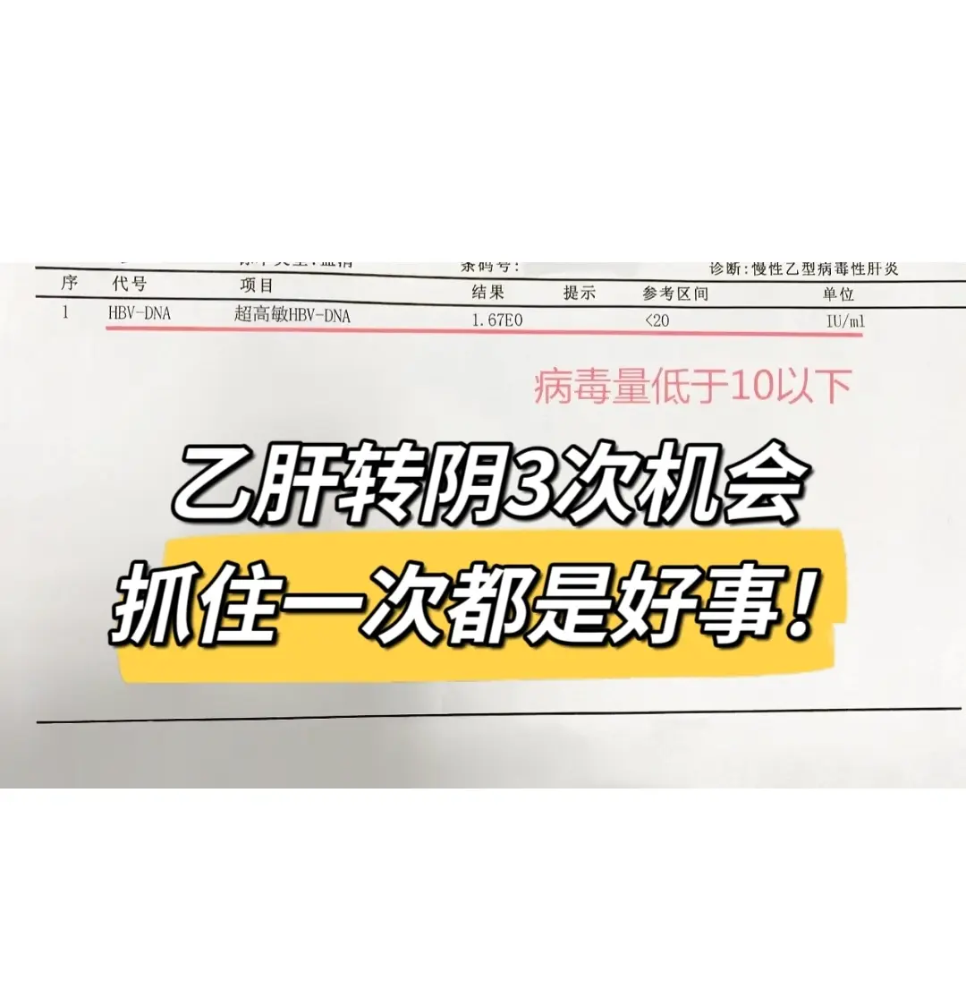 乙肝转阴3次机会，抓住一次都是好事!昨天潍坊来复诊的一个病号，大三阳...