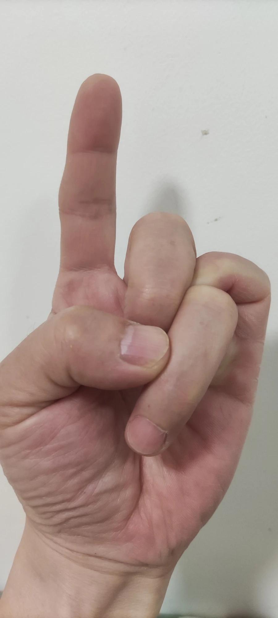 看图自拍的！估计是表现最差的！
[捂脸][捂脸][捂脸]