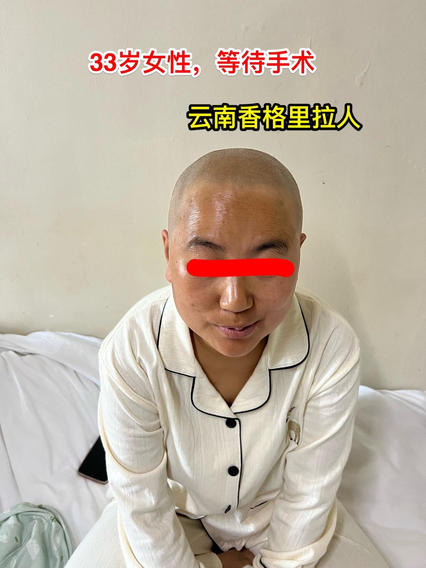 国庆节长假后第一天完成两个手术。一个手是33岁女性，来自云南省香格里拉...