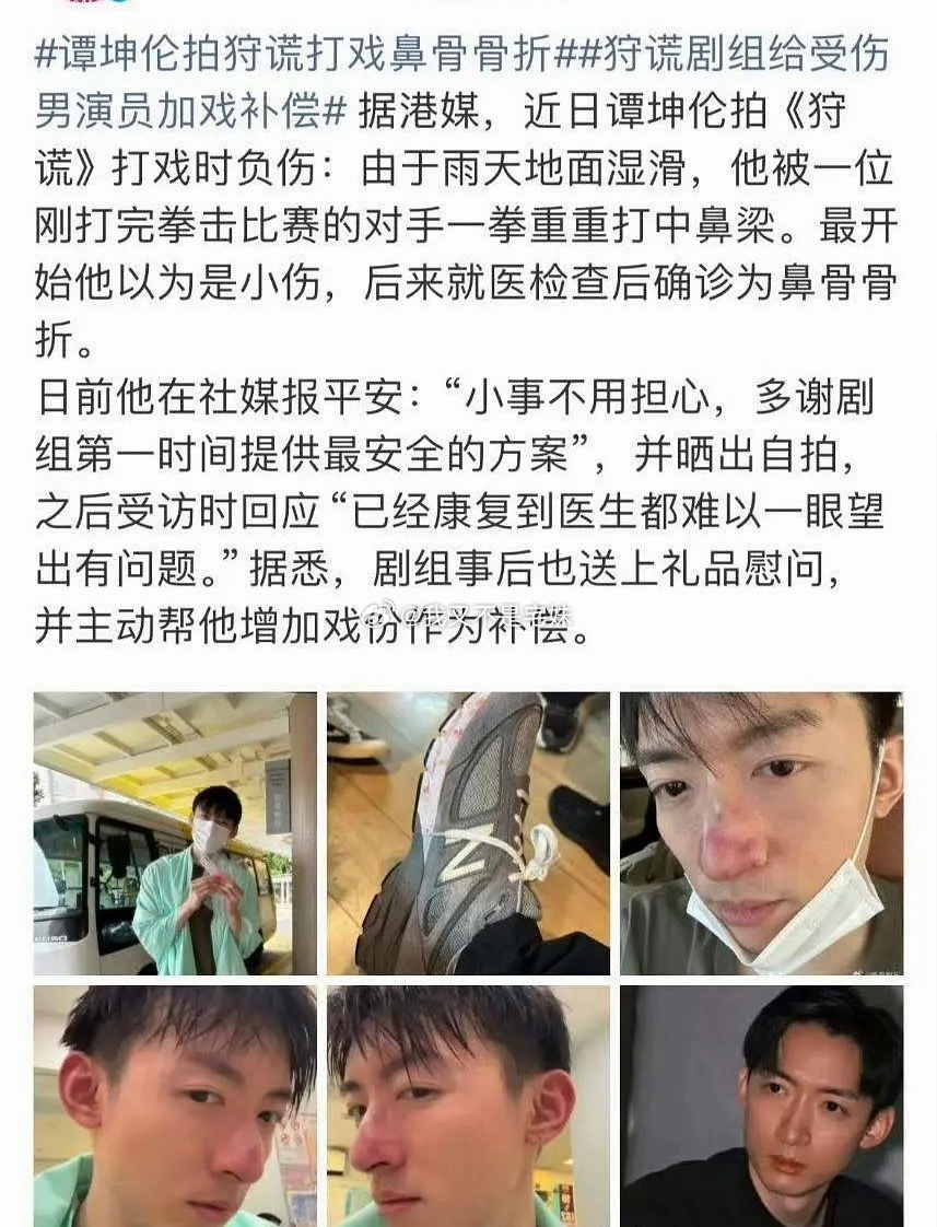 继卫诗雅缝50针之后，同剧组谭坤伦拍打戏鼻骨骨折据港媒，近日谭坤伦拍《狩谎》打戏