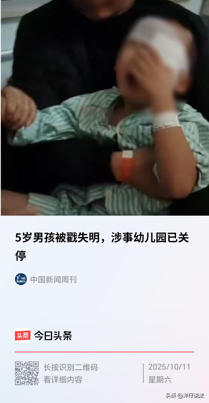 江西瑞昌，一5岁男孩在幼儿园画画时，邻座小朋友转身挥动铅笔，笔尖不慎刺入男孩的左