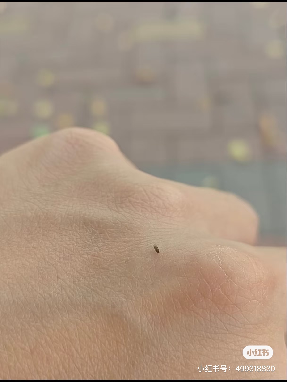 这玩意能给你咬出来一个是它身体五百倍大的包 太可怕了太可怕了 