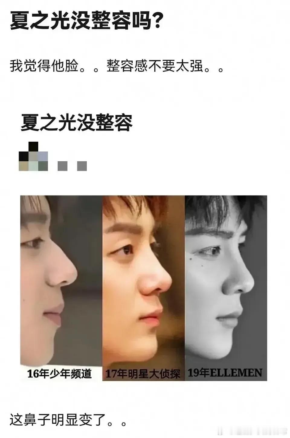 夏之光鼻子变化也太明显了…泪痣是点的还是后来长的？ ​​​