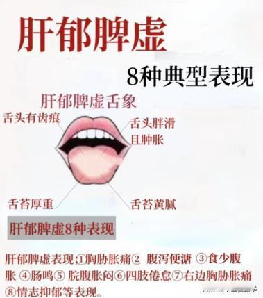 比脾虚更可怕的是肝郁脾虚，像这种舌头，参苓白术散、归脾丸吃再多也是白费力气
脾胃