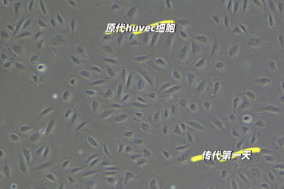 中乔新舟内皮细胞培养基试用装大量供应！