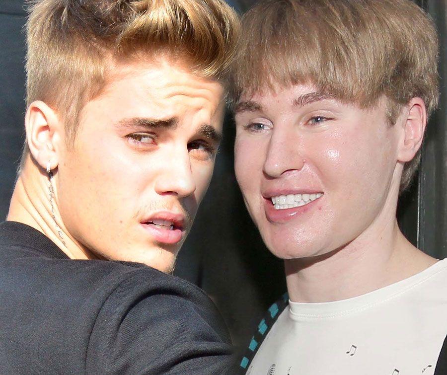 Toby Sheldon 花十万美元整容成 Justin Bieber。他做了从