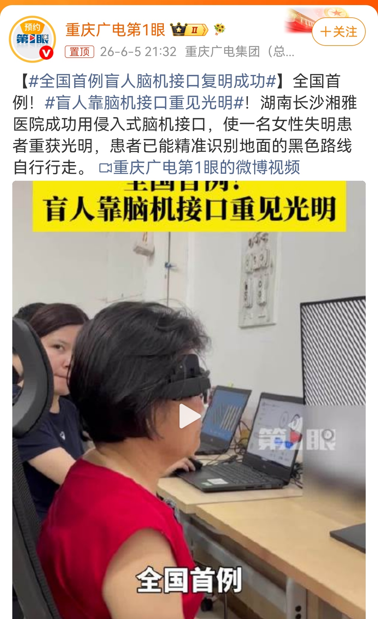 全国首例盲人脑机接口复明成功 近日，湘雅医院成功完成全国首例侵入式脑机接口手术，