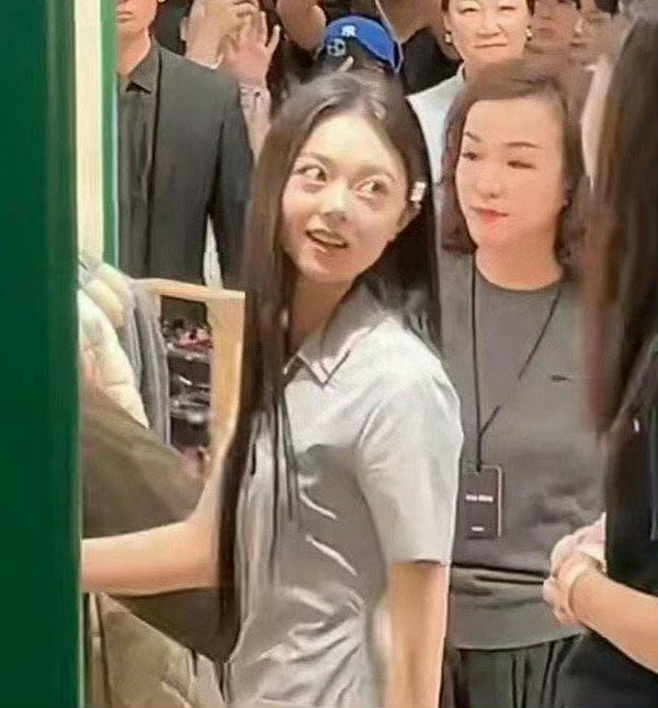 赵今麦 再不去用心治疗甲亢就脱粉