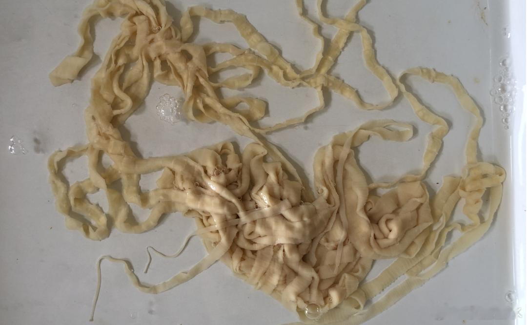 不要生吃或半生吃猪肉牛肉牛带绦虫病是由寄生于人体肠道中的牛带绦虫所引起的一种寄生