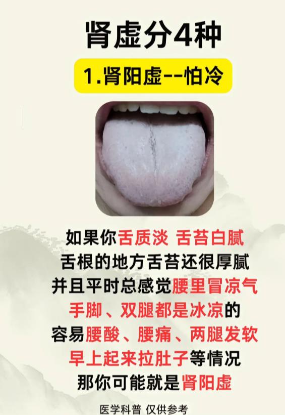 肾虚常见四大类型，中医辨证各不同