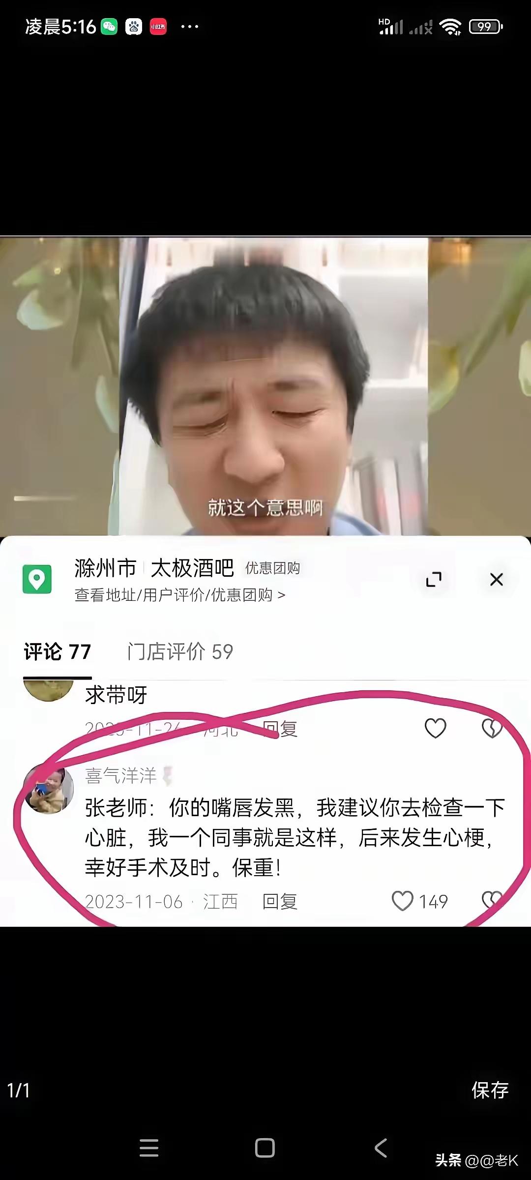 张老师：你的嘴唇发黑，我建议你去检查一下心脏，我一个同事就是这样，后 发生心梗，