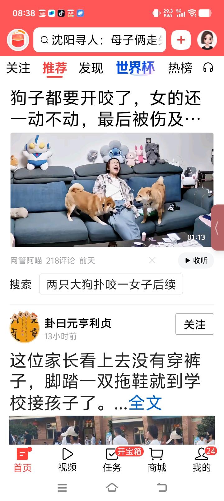 两狗打仗咬了主人，是不是有点活该！

眼看两条狗大怒，都要 一起来了，可是坐在两