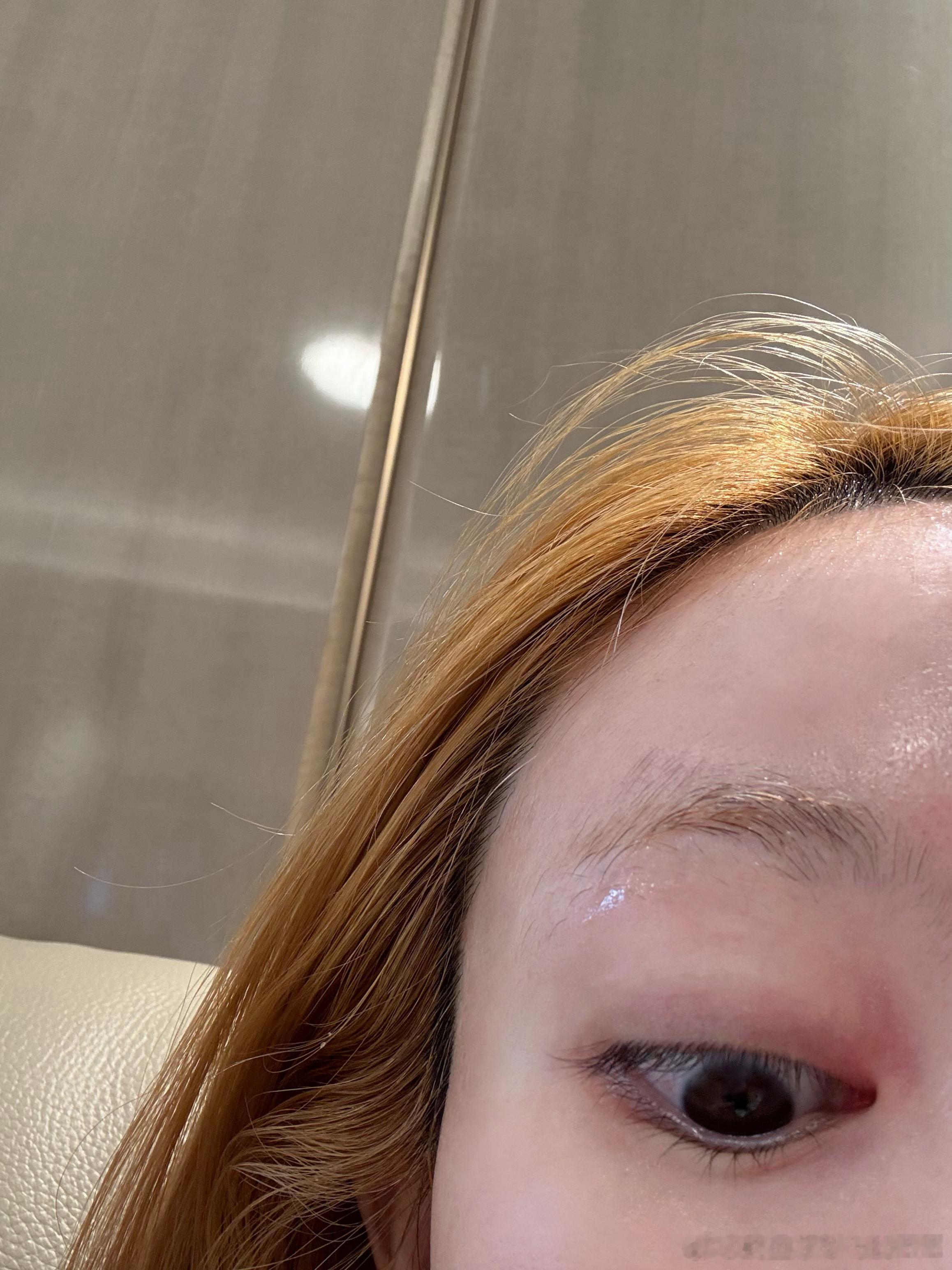 ？？我和我脑公两个人起来，在一模一样的地方一人长了一颗麦粒肿，到底咋回事啊