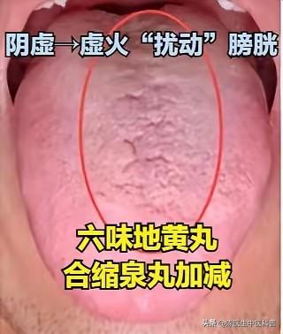 晚上频繁起夜，多是阴虚虚火扰膀胱！别瞎补肾阳
 
提示：本内容仅供健康科普，不作