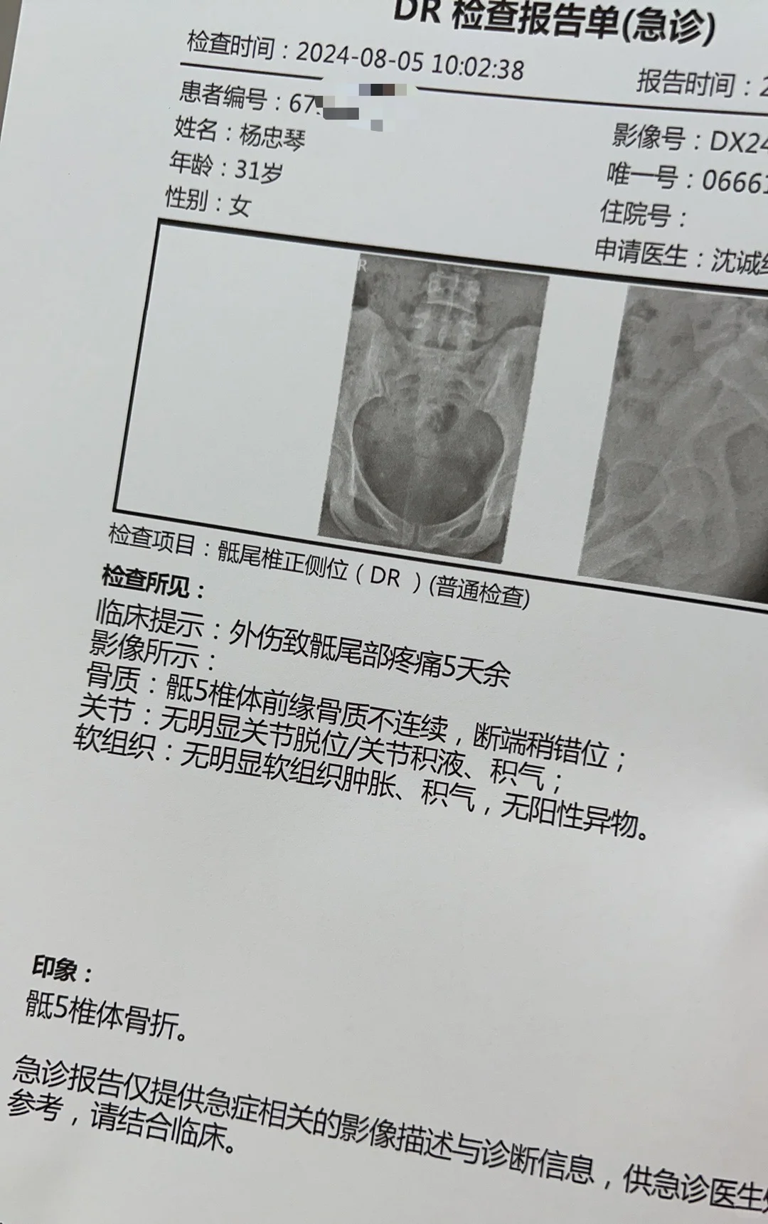 万宁冲个浪、都能骨折、只怪摔在沙滩没摔好