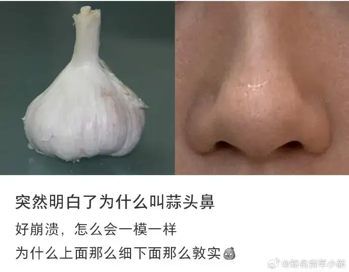 <img src=