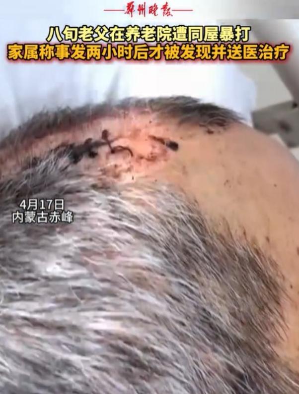 内蒙古赤峰，女子将父亲送到养老院，几天后接父亲，只见父亲裤子直接裂开到裤裆，上衣