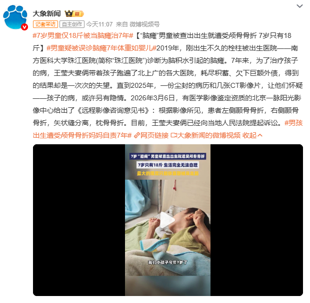 7岁男童仅18斤被当脑瘫治7年广州7岁男童栓柱，出生时评分10分一切正常，却被诊