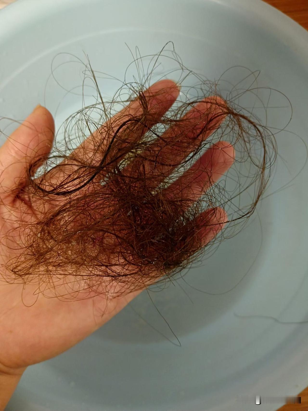 没脱贫，反而先开始脱发了。