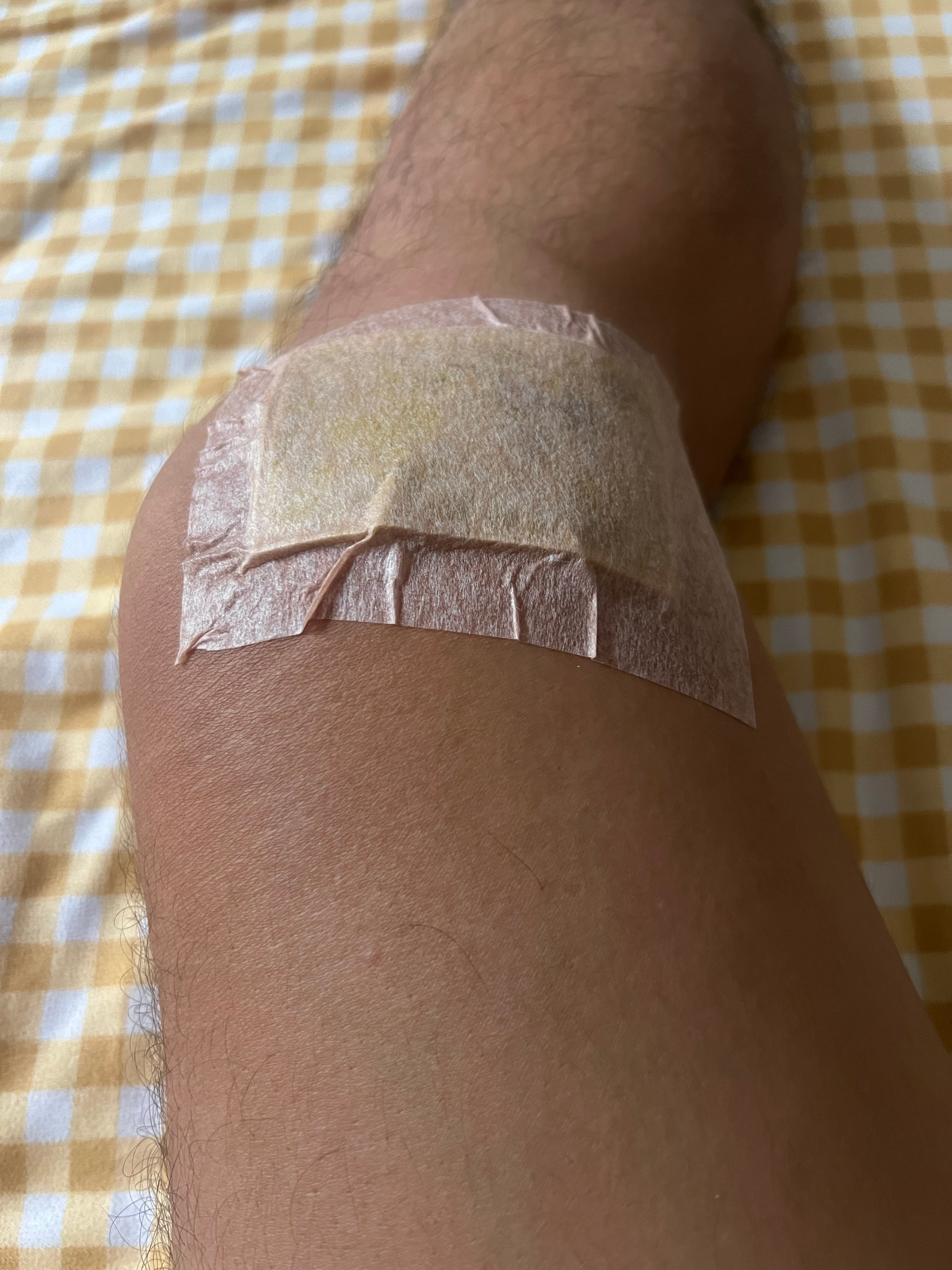 希望有惊无险，吓吓我就可以了。以后一定不逞强！已经30多岁了。欲速则不达，胜负欲