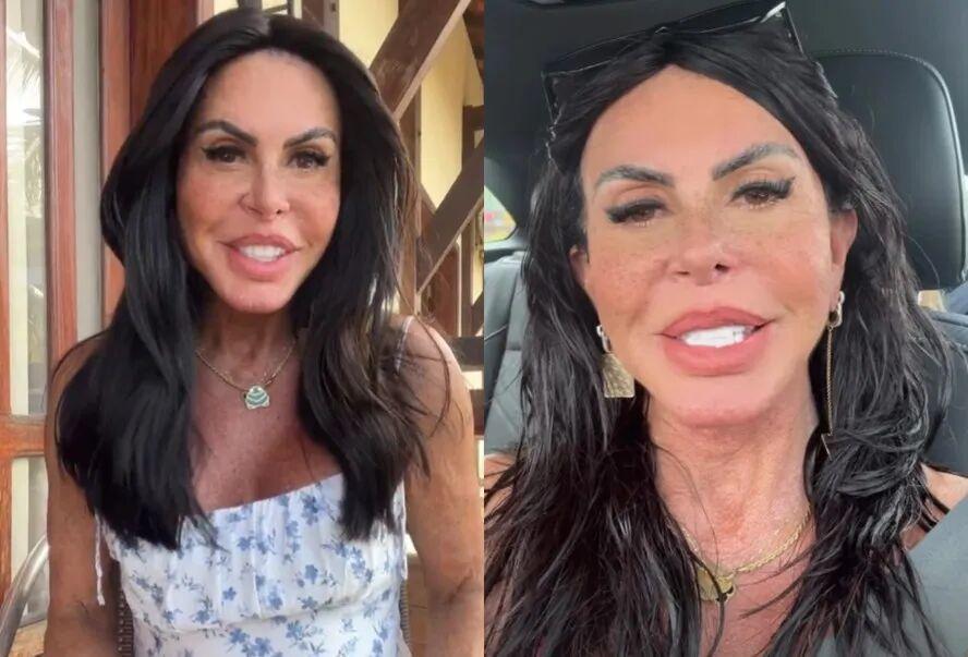 66岁巴西歌手 Gretchen 花重金整容了。