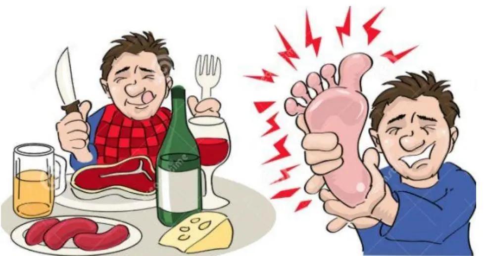 过年也是痛风的高发期
吃是件让人身心愉悦的事，尤其过年过节美食的诱惑，更是难以抵