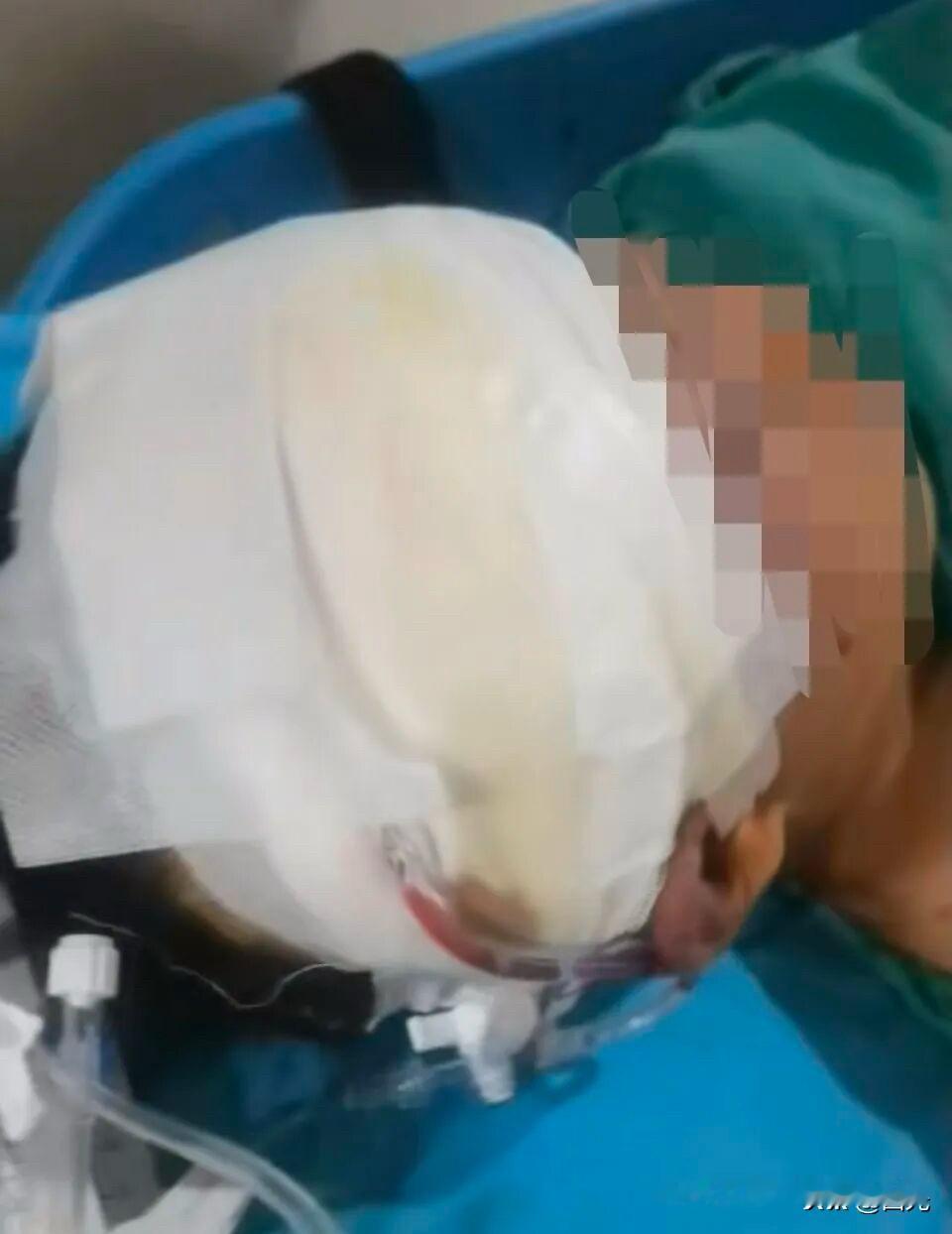 江西一13岁男生因逃学被送往湖北黄石一成长基地，第七天因写求救纸条被发现遭殴打，