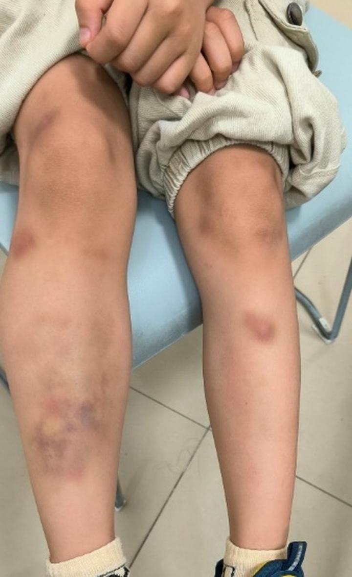 很多人认为，新鲜生菜生吃更健康、更营养，殊不知看似干净的生菜叶片缝隙中，可能暗藏