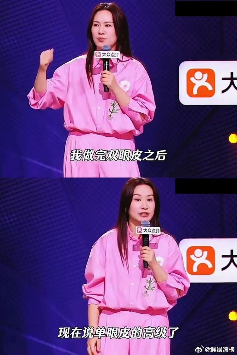 步惊云分享整容经历脱口秀和Ta的朋友们不回避整容争议，步惊云诉说内心纠结与懊悔，