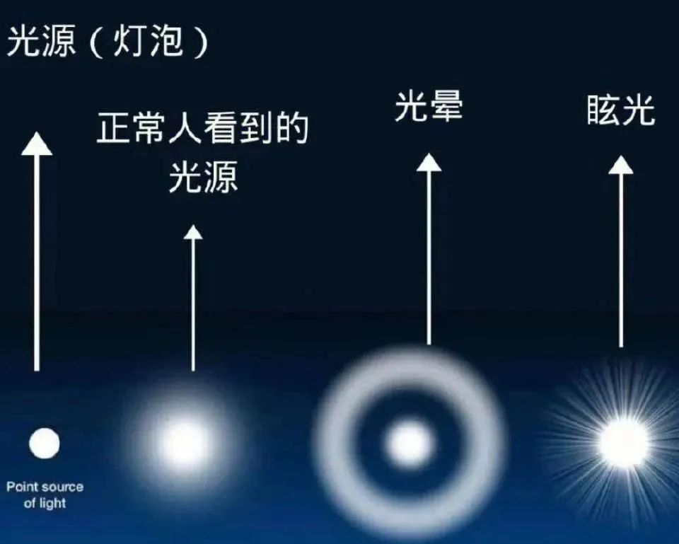近视手术后眩光是怎么回事? 每个人都有吗? 合肥普瑞专家解答来了