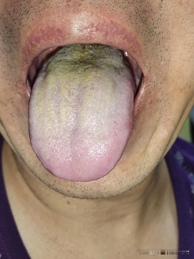 门诊大哥，刚40出头，不光男科不行，感觉身体都被他玩坏了[捂脸][捂脸][捂脸]