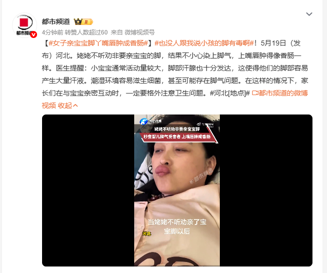 女子亲宝宝脚丫嘴唇肿成香肠 5月19日河北，一位姥姥不听家人劝阻非要亲宝宝的脚，
