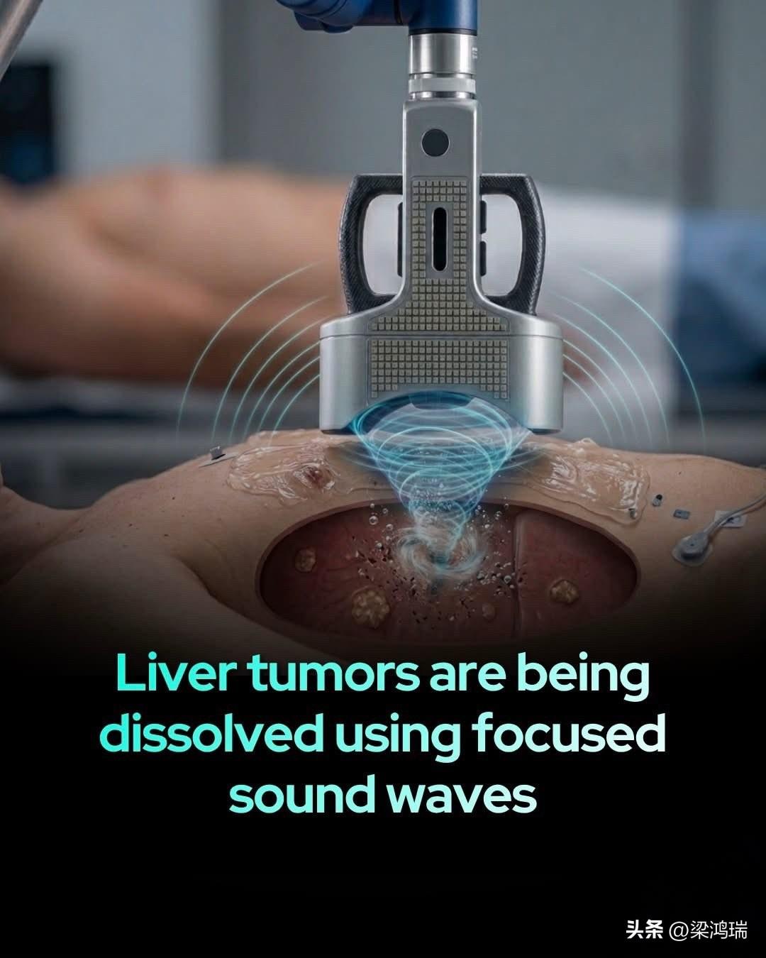 加州大学尔湾分校健康中心（UCI Health）已正式引入名为 Histotri