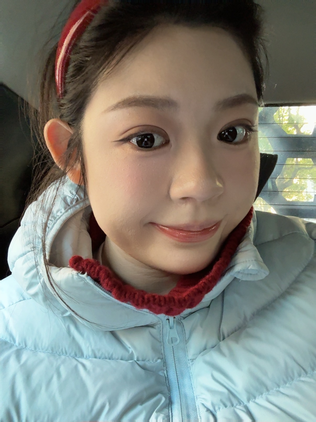 芜湖！！！今天微创蒜皮14天画了小妆很自然[哇][哇][哇][哇][哇][哇][