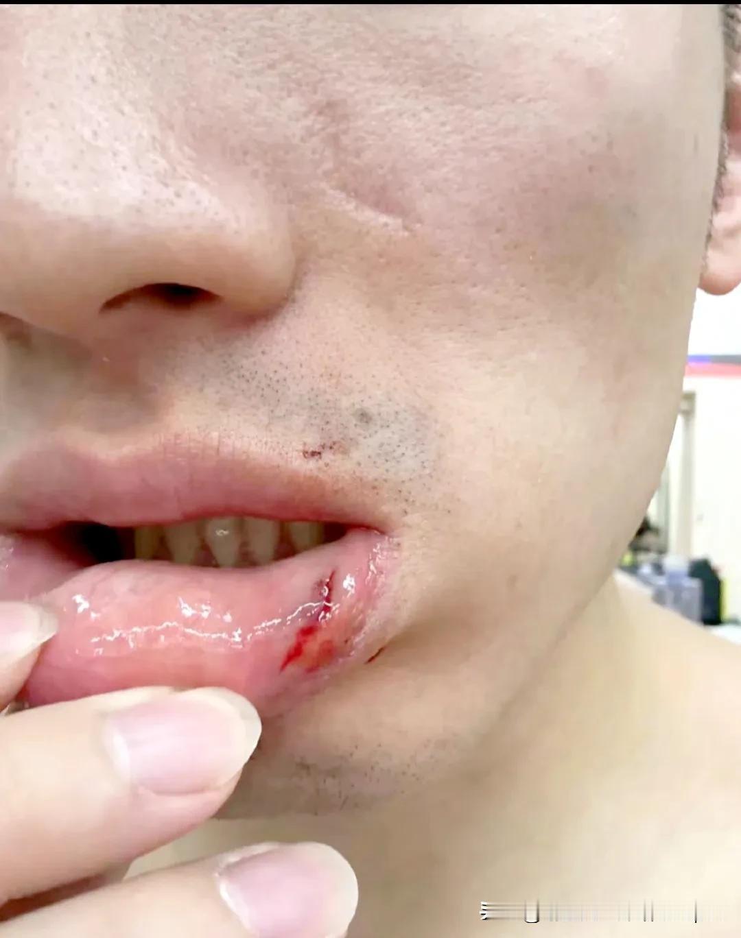 多此一举！于德豪赛后没必要翻嘴唇给大家看，福格这球有啥问题，突破还得把胳膊绑住吗
