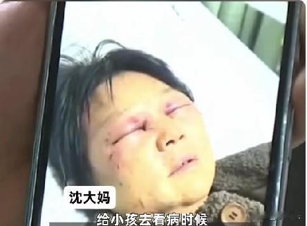 近日，浙江嘉兴一男子的妻子，打断婆婆的4根肋骨，儿子反怪母亲“有错在先”，他说母