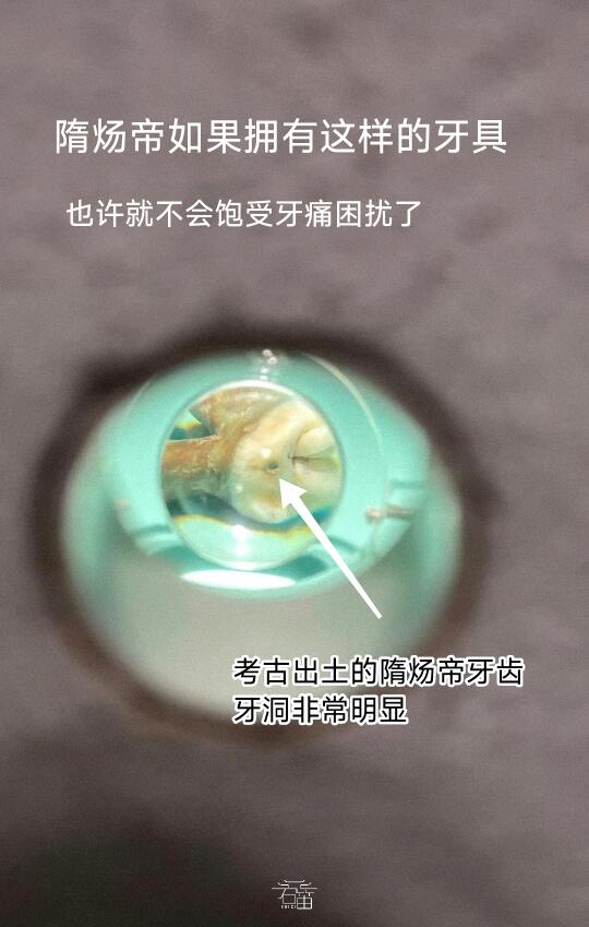 拼多多护牙神器！隋炀帝的牙洞有救了！