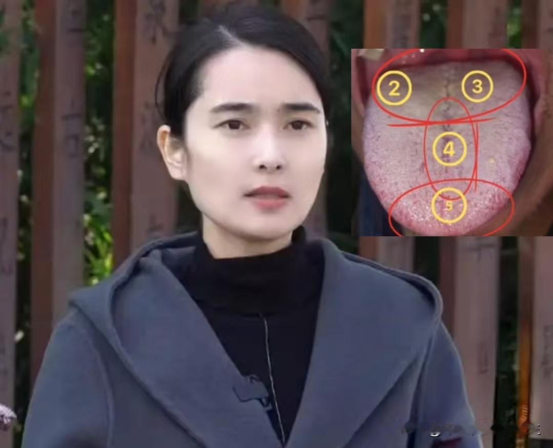 痰阻三焦，宗筋萎软，一碗汤帮你调好！

患者主诉：房事不佳，宗筋萎软，时间短，伴