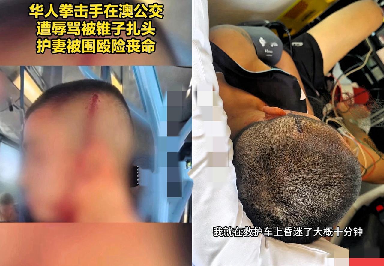 一个华人拳击手，被几个澳大利亚小烂崽打得快死了，我觉得挺丢脸的。

刚看一个新闻